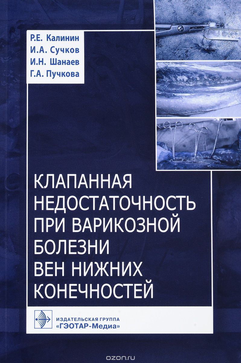 Скачать книгу "Клапанная недостаточность при варикозной болезни вен нижних конечностей, Р. Е. Калинин, И. А. Сучков, И. Н. Шанаев, Г. А. Пучкова"