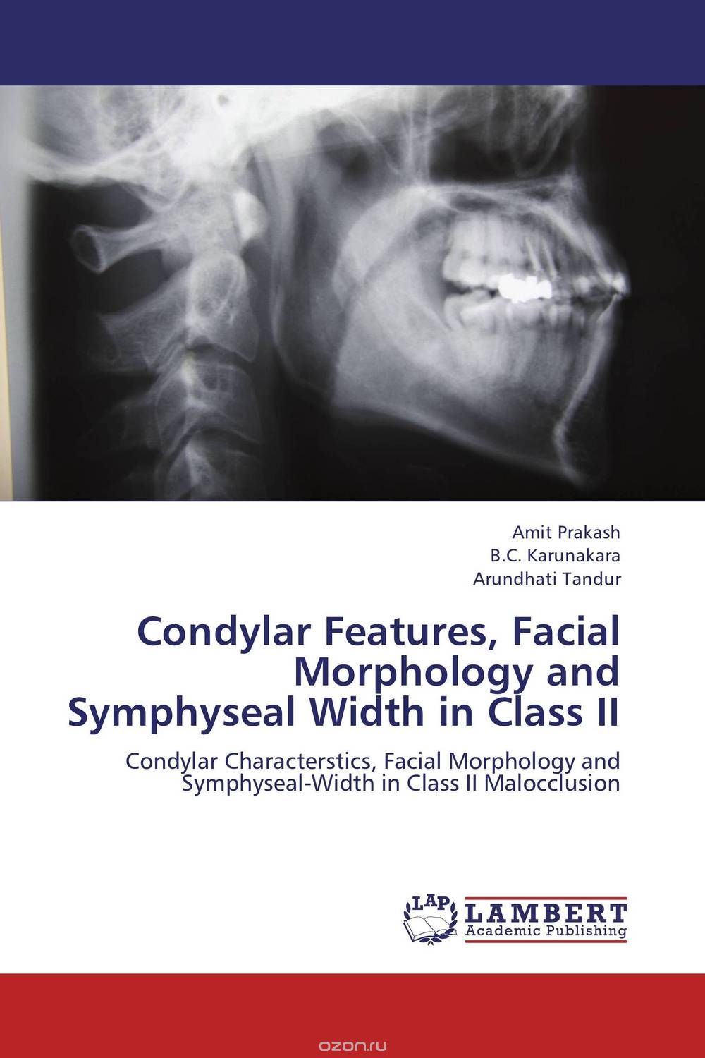 Скачать книгу "Condylar Features, Facial Morphology and Symphyseal Width in Class II"