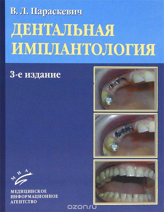 Скачать книгу "Дентальная имплантология, В. Л. Параскевич"